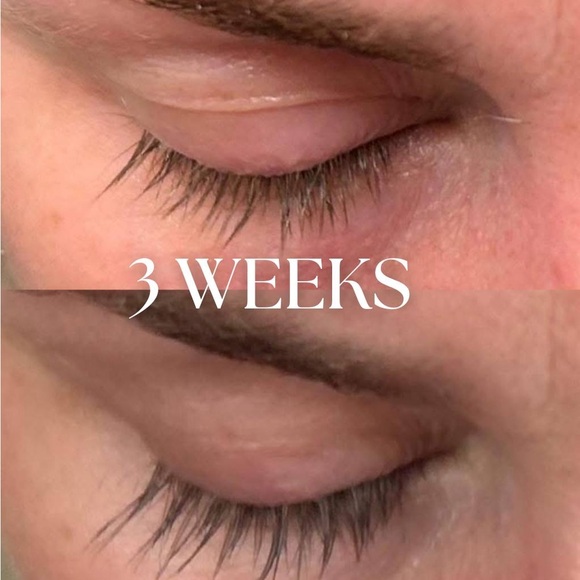 Eyelash Growth Serum Results - Picture 3 of 8